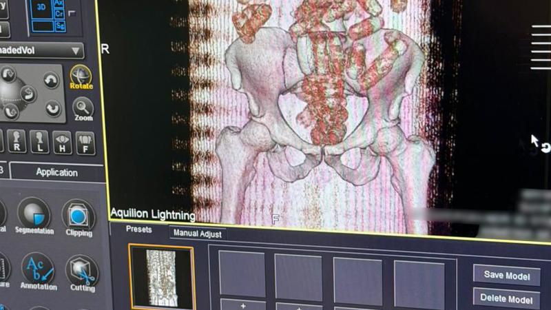 Օդային ճանապարհով քաղաքացին ՀՀ է ներմուծել 845 գրամ «կոկաին» տեսակի թմրամիջոց